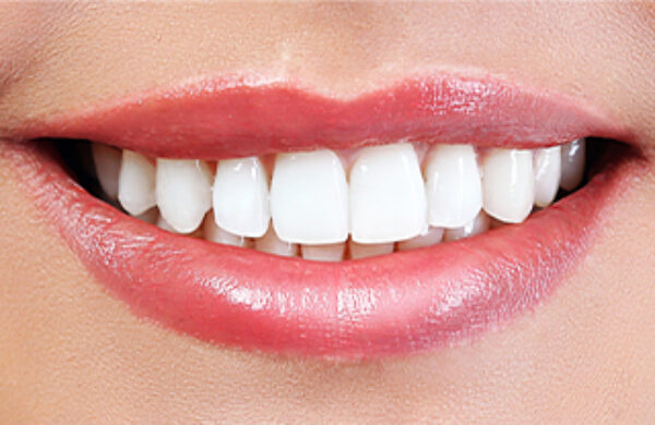 After - KT Dental